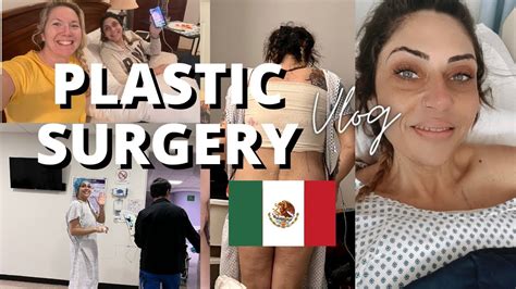 tummy tuck in tijuana cost|Tummy Tuck Surgery Tijuana, Mexico